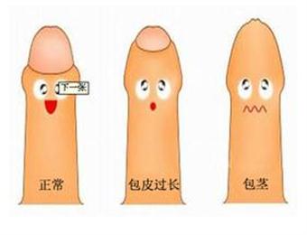 <b>[博爱.健康]退却束缚，做“清爽”男人</b>
